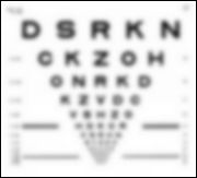 Eye Injury & Vision Loss Attorneys in Orange County