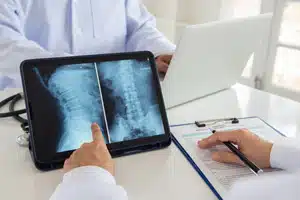 Santa Ana Spinal Cord Injury Lawyer