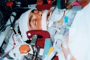 Ryan Corbin, a victim of skylight injury