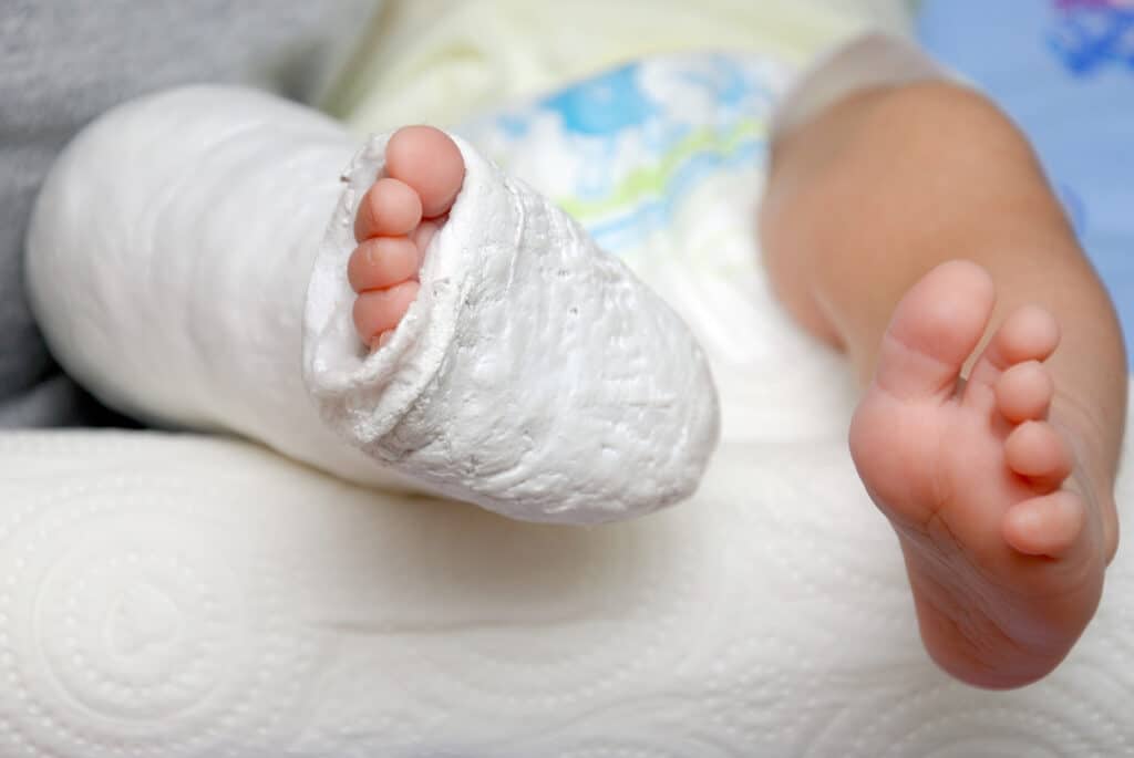 Orange County Injuries to Children lawyers