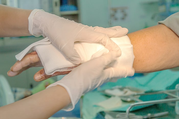 orange county burn injury attorney